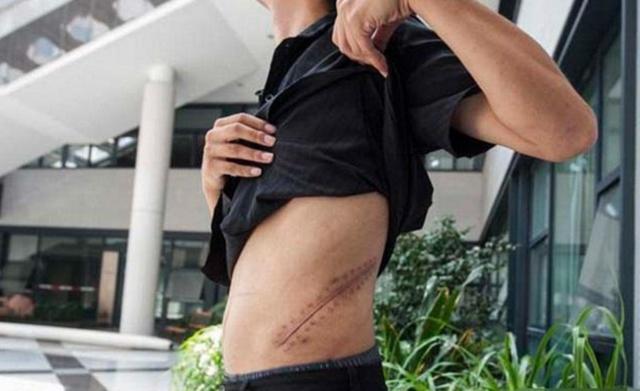 父母|那个“卖肾”买苹果手机的高中生,现状如何?网友:赔上了一辈子