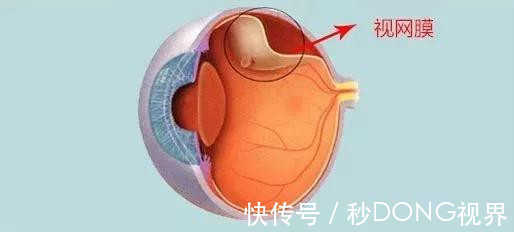 家长们|保护视力,拒绝近视!家长们看这里!