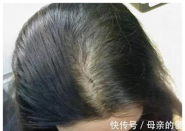 睡眠质量|浙江45岁女子,每天服用叶酸,半年后,身体怎么样了?