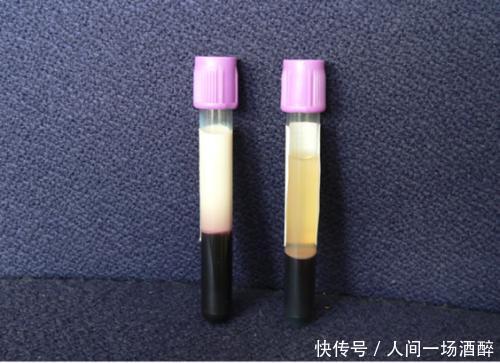  甘油三酯|甘油三酯的“清洁工”找到了，每天可劲吃，血脂降了，血管通了