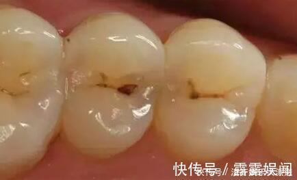 口腔|为什么牙缝里掏出来的东西很臭这些方法可以解决