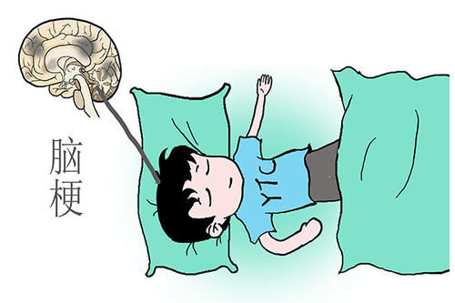 中风不是说得就得的，59岁阿姨，及时发现身体异常，救了自己一命