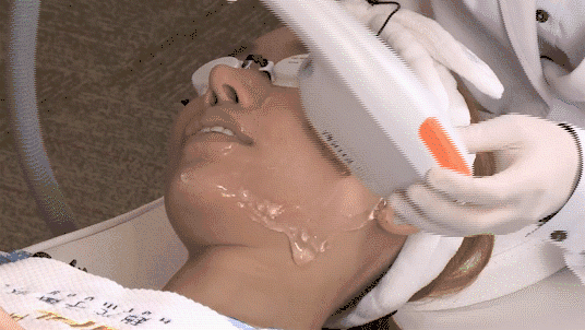 变美 有没有什么快速拯救颜值的变美神器?这些医美安排上,你就是最靓的仙女~