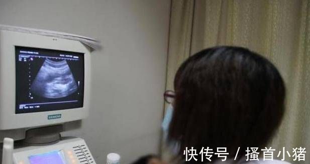 医生|怀孕8个月突然来例假,老公急忙送医院,医生检查后连连道喜