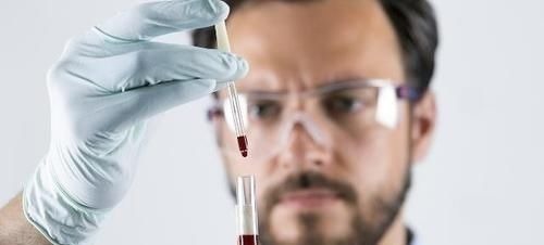 长期|肝硬化才不会“悄无声息”,早期信号一定别忽视,还好早知道