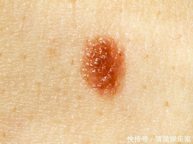 早晨是养肝“黄金期”，尽量做到这三点，助你有效“抵御”肝病