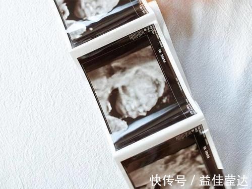 准确率|产检正常,生下唐氏儿,我可以起诉医院吗?能胜利吗?