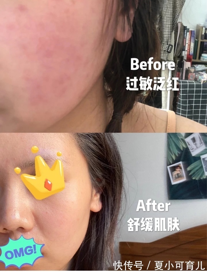 肌肤 已被拉入“黑名单”的护肤品,皮肤科医生都不敢用,孕妈还在囤?