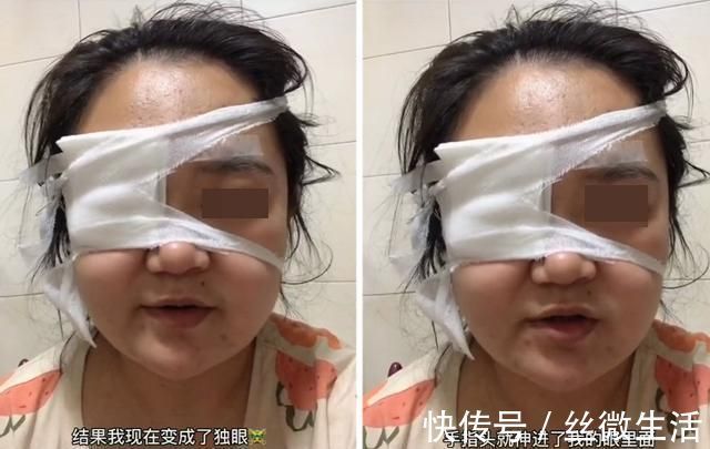 敏感期|妈妈被宝宝戳伤变“独眼龙”,诚心告诫父母:带娃时要保护好自己