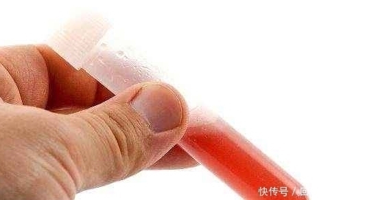 rh血型|这两种血型的女人，第一胎尽量不要流掉，第一个孩子对你很重要