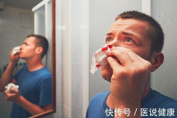 出血|肝脏出问题时,身体或有4种症状表现,若你有,该养肝了