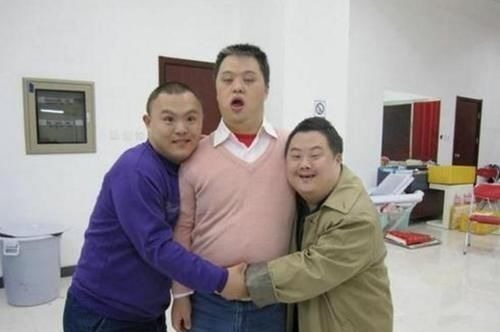 血清标志物|为什么唐氏综合征的人都长着“同一张脸”?唐氏综合征到底是啥?