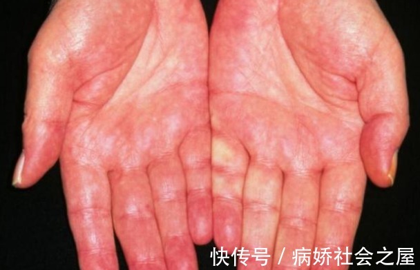 老中医|88岁老中医研究肝脏50年!只留给你一句话:常吃这一物肝脏更健康