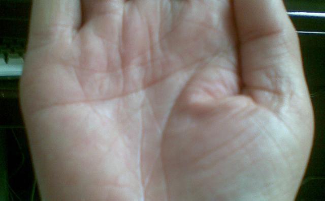 降血糖|你清楚“糖尿病”吗?如何降“血糖”?建议:常吃以下这5种食物