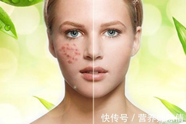 难题|毛孔粗大成难题:女生毛孔粗大真的没救了吗?