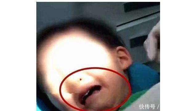 牙齿|6岁男童被查出牙龈癌晚期,牙齿掉光了,孩子爱喝家长要警惕