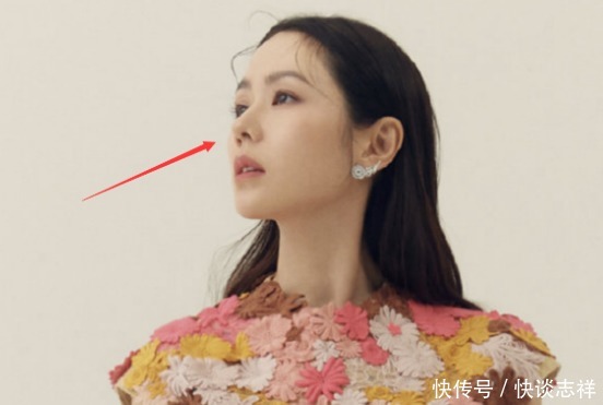 鼻尖抬高,鼻翼惊现疤痕,号称天然美女代名词的她,也翻车了?