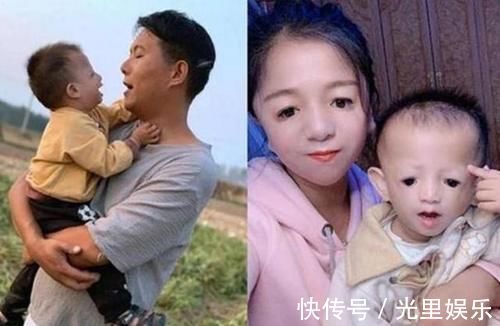 反对|“鸟脸妈妈”生孩子遭家人反对,宝宝出生后,妈妈十分后悔