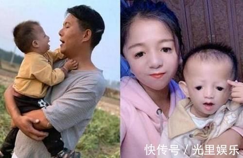 反对|“鸟脸妈妈”生孩子遭家人反对，宝宝出生后，妈妈十分后悔