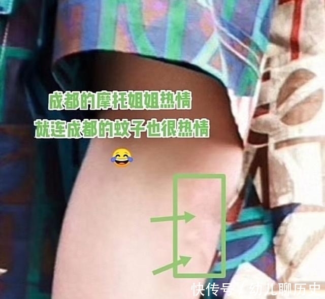 郑云龙|王一博录节目被蚊子“咬惨了”!胳膊上都是包,看到数量粉丝笑了