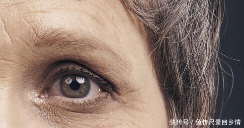 皮肤|肌肤变老的“祸根”,不仅是熬夜,还有3件事,平时劝你少接触