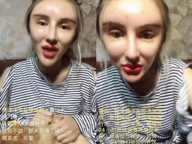 现状|花400多万做200次整容手术的“红粉宝宝”,现状让令人唏嘘