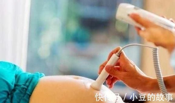 胎心率|二胎又是可爱的女儿,孕期4大症状分享给大家,接好孕