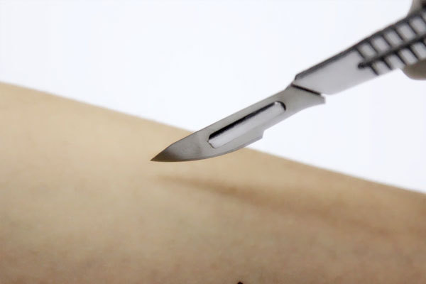 身体免疫力|大爷“与癌共存”10年，期间一直没扩散，他的方法，其实很简单