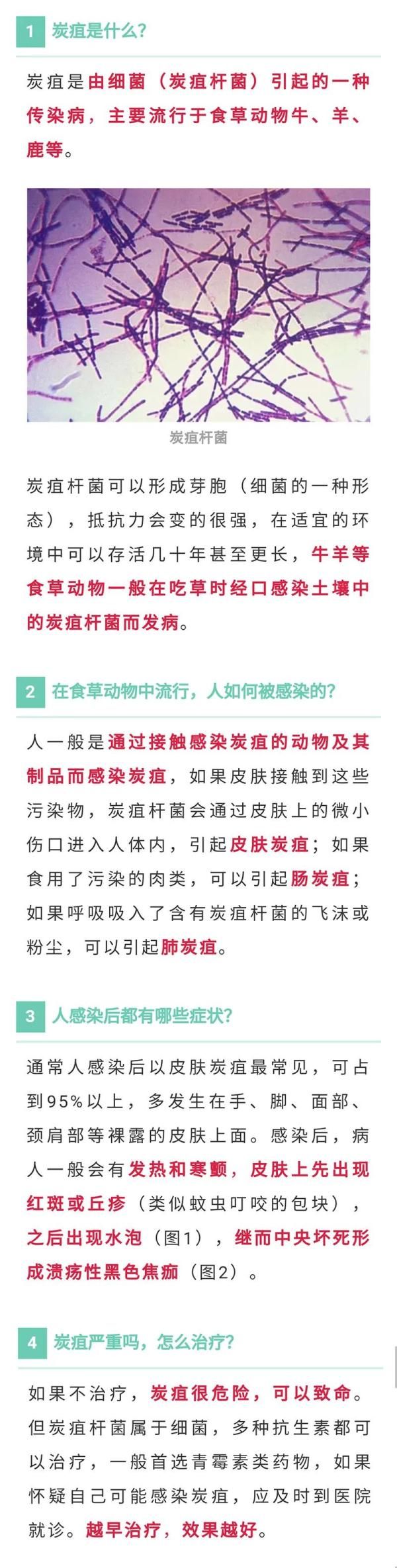 就诊|北京市报告1例外地来京就诊肺炭疽病例，属乙类传染病甲类管理