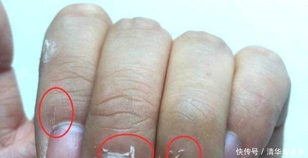 内分泌失调|没有妇科疾病的女人，手上有4个特征，你若占1个，子宫很健康