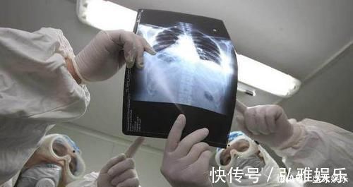 胸片|55岁男子，体检正常5个月后查出晚期肺癌去世体检到底有何用