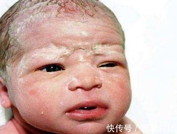 小美|宝妈太爱干净了,出生15天后,她的孩子被送到了医院,医生责备宝妈无知