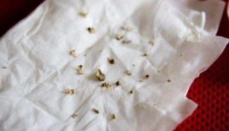 牙缝里“臭烘烘”的东西是啥?多半是此物在“捣鬼”,别忽视了