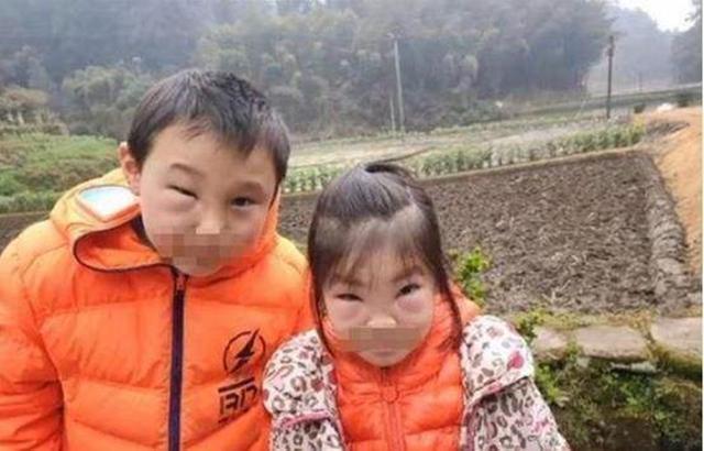 安全意识|熊孩子兄妹误捅马蜂窝,脸肿得爹妈不敢认,网友:不该笑但忍不住