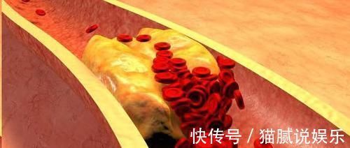 素问玄机原病式|血脂高的人,早晚坚持“1件事”,血管年轻20岁,离长寿又进一步