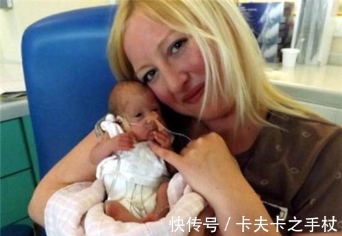 巨大儿|美国一女婴,出生时仅25厘米,体重280克,15年过去美的移不开眼