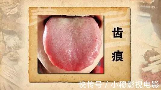 气血|肝病偷袭,“嘴”先报告,4个症状一目了然,希望你一个不占