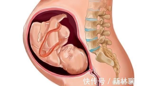 准妈妈|怀孕晚期,小宝贝“入盆”早晚,或许和这4点有关系,早知早好