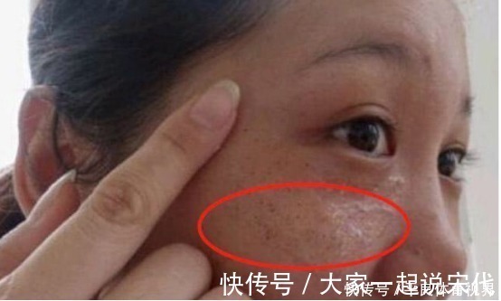 中国人大|中医明说脾胃不好,全写在脸上,多吃3种食物,脾脏强壮健康