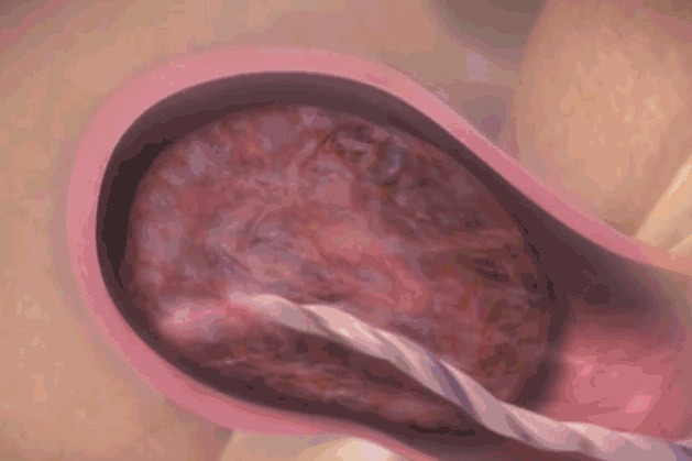 胎盘|顺产到底有多疼3张图让你一目了然,妈妈太不容易,请善待她们