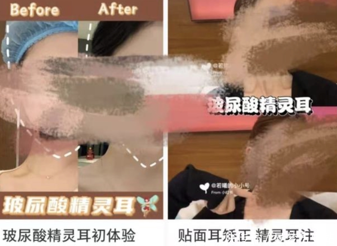 猴相|好奇葩……