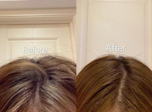 头痒、头皮屑如雪花？3款容易“踩雷”的洗发水别用，阿道夫上榜