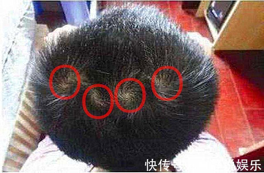 二旋宁|孩子头上有几个旋,就会有什么样的人生许多爸妈不知道