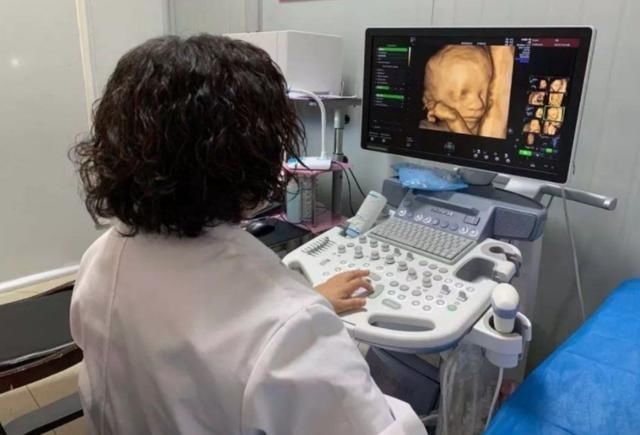 胎宝|孕期进入第28周,准妈妈要做到“3小心”,对自己和胎宝都有利