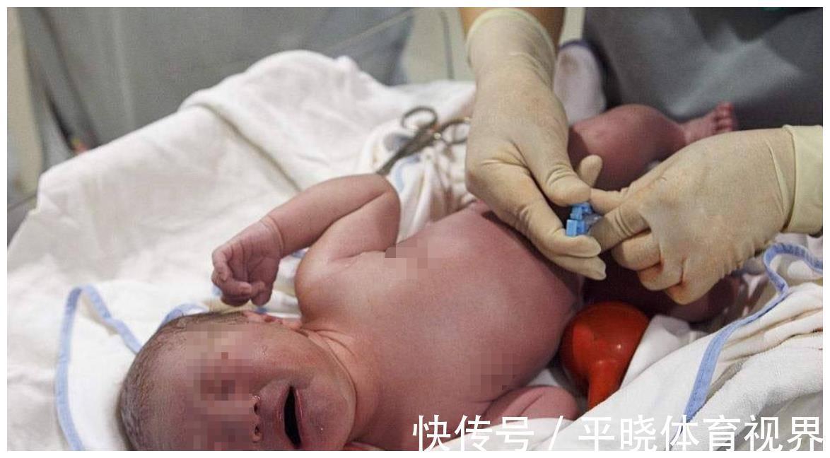 产妇|剪断脐带时,你了解孩子有多疼吗?说出来你都不一定会信