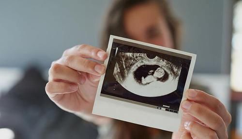 b超|每次产检结果正常,孩子生出后发现畸形,医院需要负责吗?