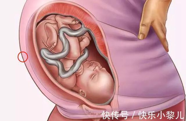 小微|准妈妈“抠肚脐” ，胎宝出生后总是肚子痛？真正的影响有3点