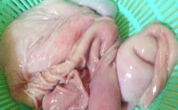 不焯水不能吃的四种蔬菜, 很多人不懂, 吃了肠胃不适