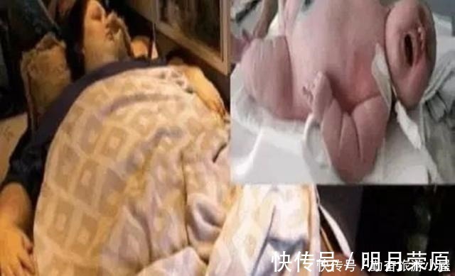 过度肥胖|500斤孕妇进医院成功顺产,母子平安,丈夫看到宝宝后却愣在原地