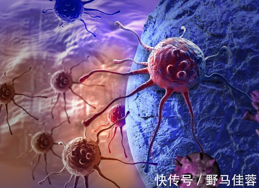 癌症|癌细胞扩散时,身体会慢慢出现4种感觉,别再忽略了
